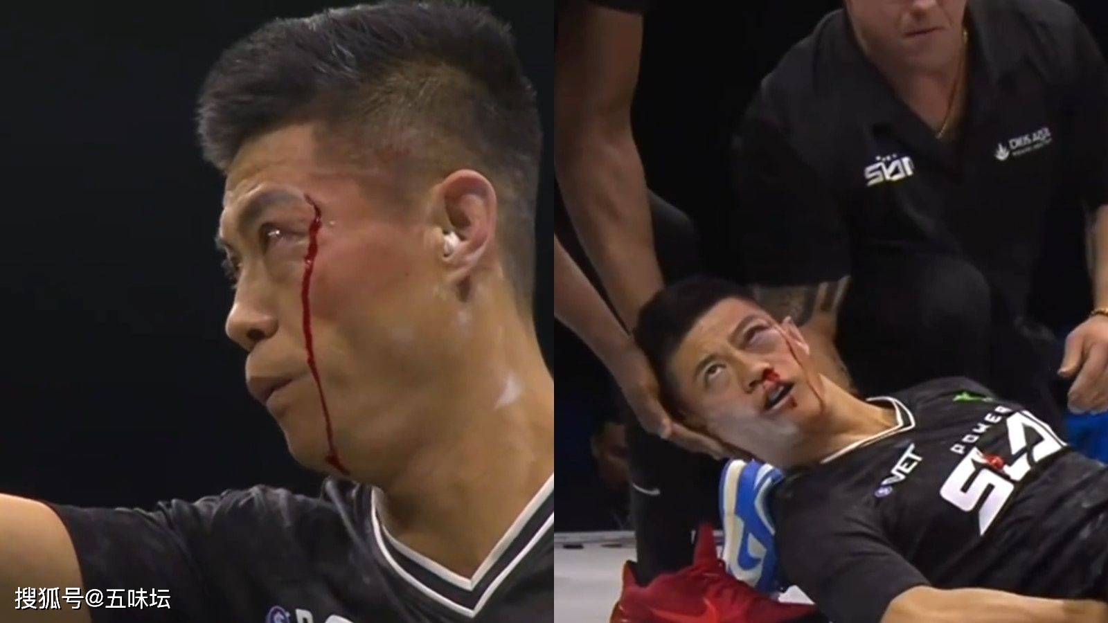 关于津门虎门将方镜淇归队5月份在比赛中遭遇重伤的信息  第1张